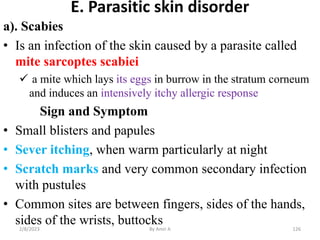 E. Parasitic skin disorder
a). Scabies
• Is an infection of the skin caused by a parasite called
mite sarcoptes scabiei
 ...