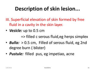 Description of skin lesion...
III. Superficial elevation of skin formed by free
fluid in a cavity in the skin layer.
• Ves...