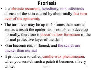 Psoriasis
• Is a chronic recurrent, hereditary, non infectious
disease of the skin caused by abnormally fast turn
over of ...
