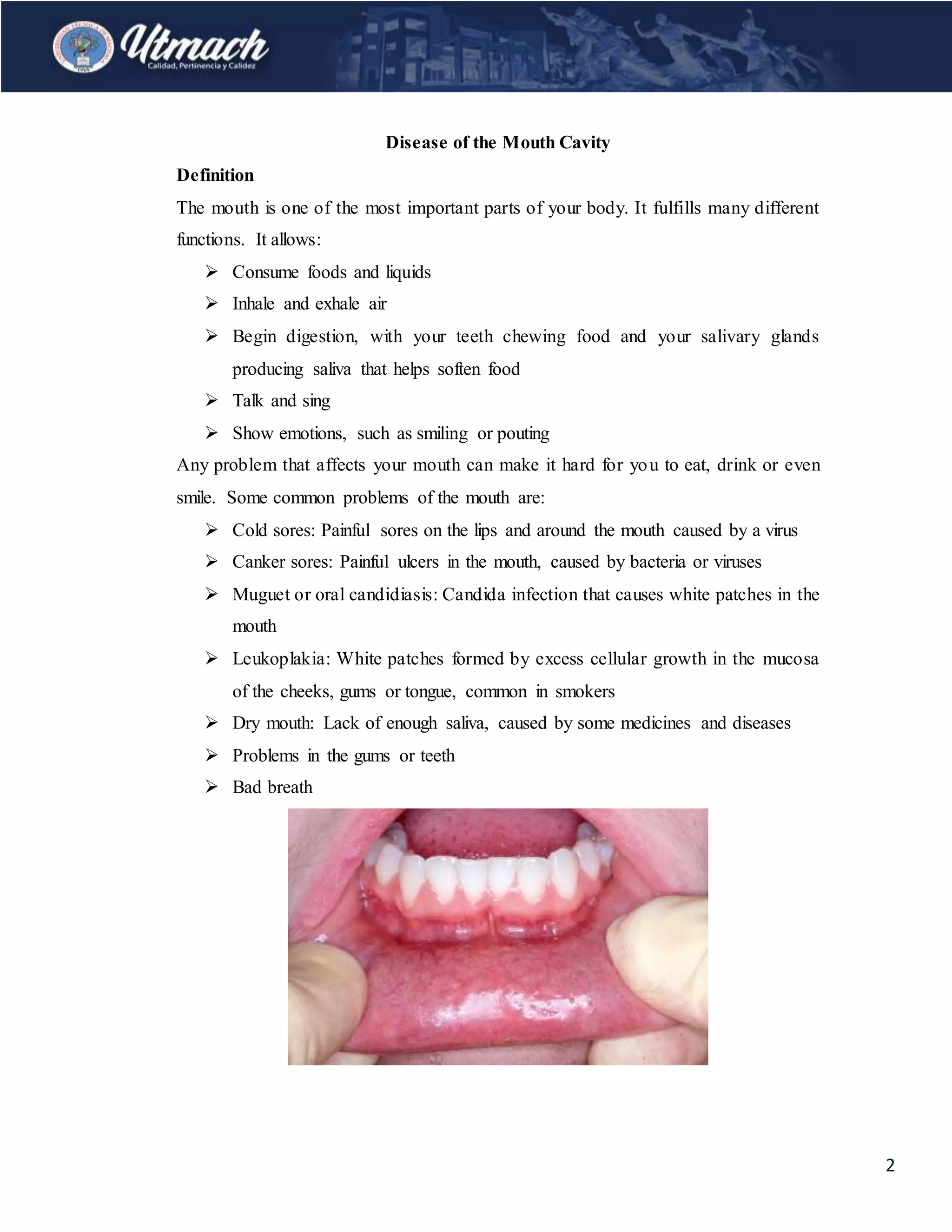 Disease of the mouth cavity | DOCX