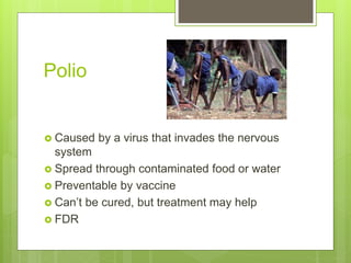 Polio
 Caused by a virus that invades the nervous
system
 Spread through contaminated food or water
 Preventable by vaccine
 Can’t be cured, but treatment may help
 FDR
 