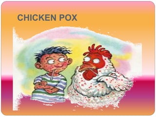 CHICKEN POX