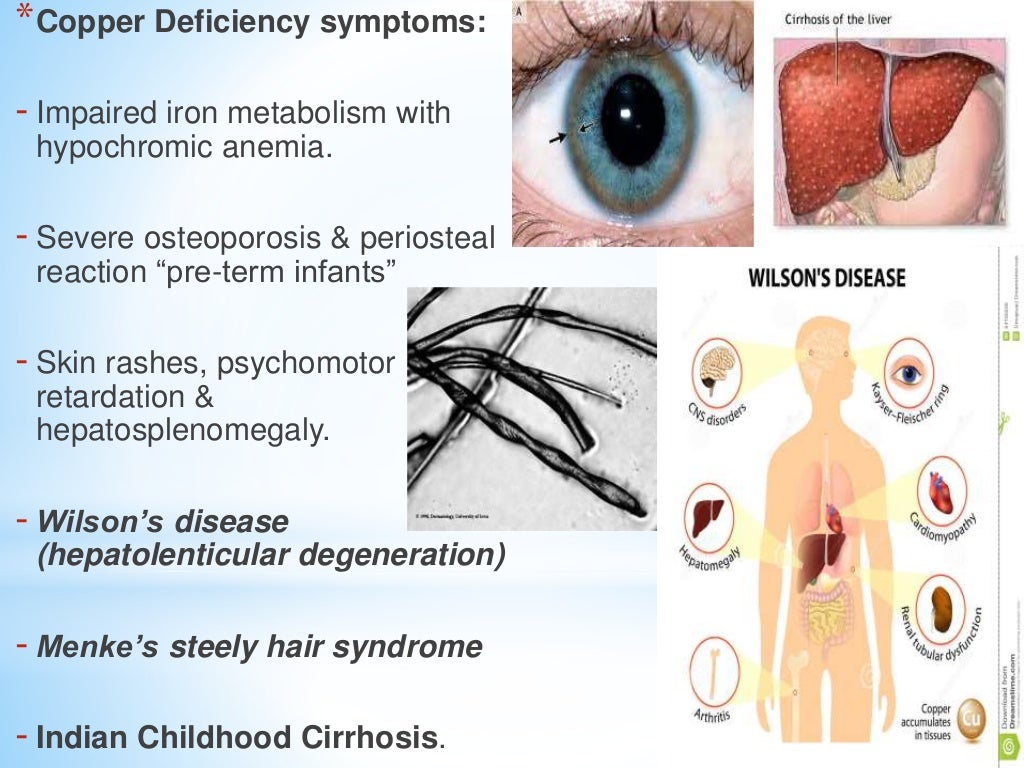 Diseases associated with defeciency of essential trace elements