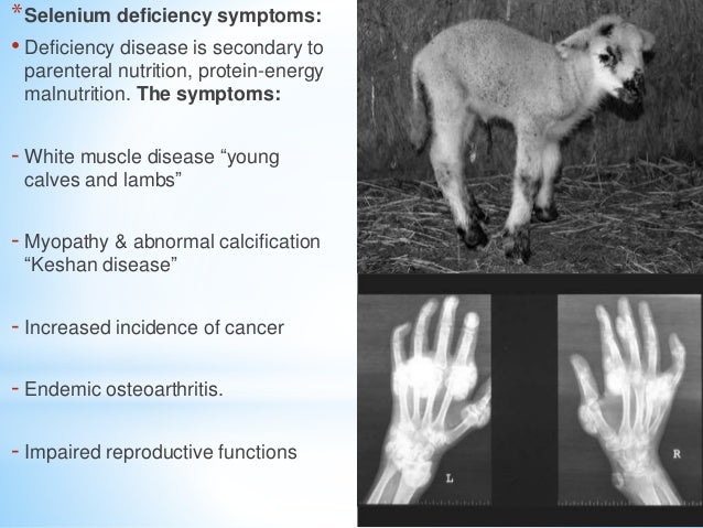 white muscle disease lamb white muscle disease