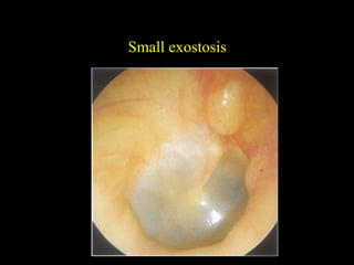 Diseases of external ear ug dr.s.vijaya sundaram 01.02.16
