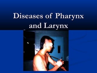 Diseases of PharynxDiseases of Pharynx
and Larynxand Larynx
 