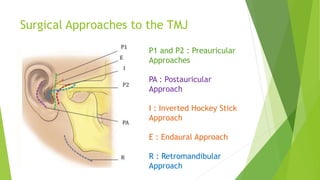 classification-of-diseases-of-tmj-and-tmj-ankylosis-in-detail-pptx