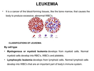 Comprehensive Overview of Blood Disorders: Anemia, WBC Disorders ...