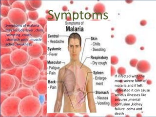 Symptoms
Symptoms of malaria
may include fever ,chills
,vomiting ,couch
,stomach pain , muscle
aches ,weakness .
If infected with the
most severe form of
malaria and if left
untreated it can cause
serious illnesses like
seizures ,mental
confusion ,kidney
failure ,coma and
death .
 