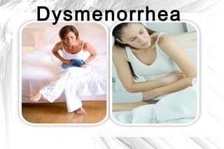 Dysmenorrhea

 