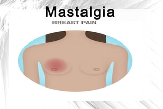 Mastalgia

 