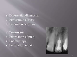 Diseases for pulp and periapical tissues | PPTX