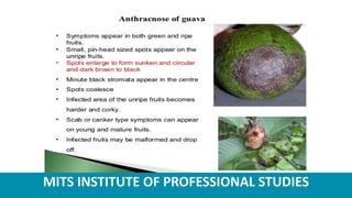 MITS INSTITUTE OF PROFESSIONAL STUDIES
 