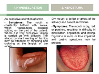 1. HYPERSECRETION                       2. XEROSTAMIA


   An excessive secretion of saliva.     Dry mouth; a defect or arrest of the
    - Symptoms: The mouth is               salivary and buccal secretions.
    constantly bathed with saliva,         - Symptoms: The mouth is dry, red,
    which      necessitates    frequent
    spitting on the part of the patient.   or parched, resulting in difficulty in
    Where it is very excessive, talking    mastication, deglutition, and talking.
    is carried on with difficulty. The     Digestion is more or less impaired,
    almost constant wetting of the lips    and gastric symptoms may be
    may be attended by chapping and
    cracking at the angles of the          present.
    mouth.
 