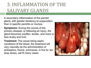 3. INFLAMMATION OF THE
      SALIVARY GLANDS
   A secondary inflammation of the parotid
    gland, with greater tendency to suppuration
    than in specific parotitis or mumps.
   Symptoms: During the course of the
    primary disease, or following an injury, the
    gland becomes swollen, tender, and more or
    less dusky and livid.
   Treatment: The cause being septic
    conditions of the blood, the treatment will
    very naturally be the administration of
    antiseptics; hence, echinacea, in five to- ten
    drop doses, will fit many cases.
 