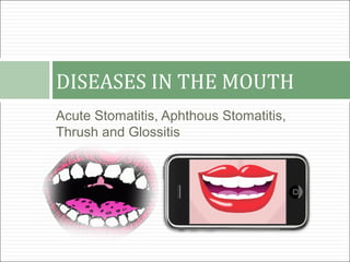 DISEASES IN THE MOUTH
Acute Stomatitis, Aphthous Stomatitis,
Thrush and Glossitis
 