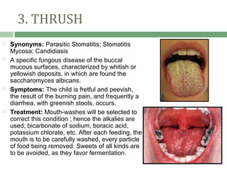 3. THRUSH
   Synonyms: Parasitic Stomatitis; Stomatitis
    Mycosa; Candidiasis
   A specific fungous disease of the buccal
    mucous surfaces, characterized by whitish or
    yellowish deposits, in which are found the
    saccharomyces albicans.
   Symptoms: The child is fretful and peevish,
    the result of the burning pain, and frequently a
    diarrhea, with greenish stools, occurs.
   Treatment: Mouth-washes will be selected to
    correct this condition ; hence the alkalies are
    used; bicarbonate of sodium, boracic acid,
    potassium chlorate, etc. After each feeding, the
    mouth is to be carefully washed, every particle
    of food being removed. Sweets of all kinds are
    to be avoided, as they favor fermentation.
 