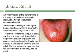 3. GLOSSITIS
   An inflammation of the parenchyma of
    the tongue, usually terminating in
    resolution, though suppuration
    occasionally results.
   Symptoms: Swelling of the tongue
    begins rapidly, soon filling the mouth,
    and even protruding from the lips.
   Treatment: Where the tongue is badly
    swollen and tense, soft linen cloths
    dipped in a solution of glycerin and
    potassium chlorate and hydrastis, and
    applied to the tongue, give the greatest
    relief. Alkaline washes or even cracked
    ice placed on the mouth may also be
    used.
 