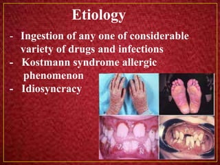 Diseases involving white blood cells in oral pathology | PPTX