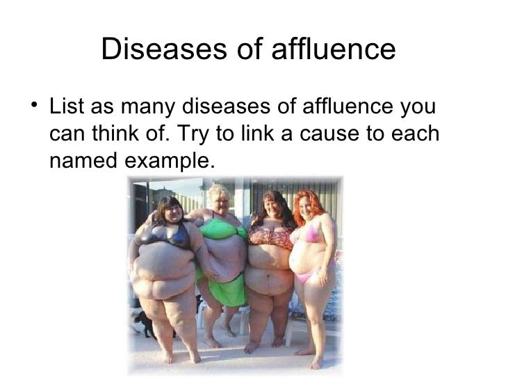 diseases of affluence 3 728 jpg cb 1236663032 which is a disease of affluence