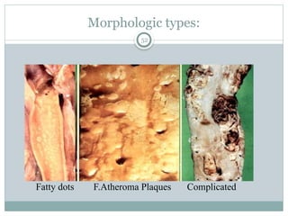 Diseases of blood vessels, DR ISAk pathology | PPTX