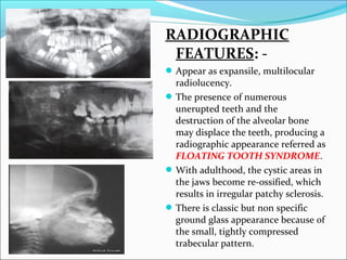 Floating Tooth Diseases of bone and its oral aspects | PPT