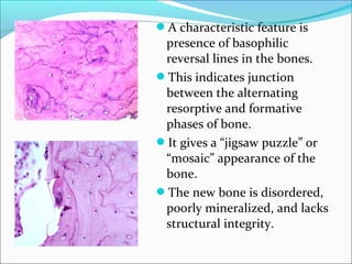 TYPES: - 
1. Eosinophilic granuloma of bone: solitary / multiple 
bone involvement without systemic organ 
involvement. It...