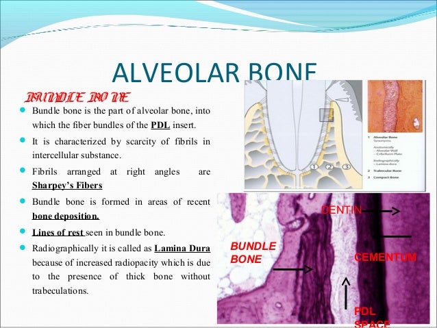 Diseases of bone and its oral aspects