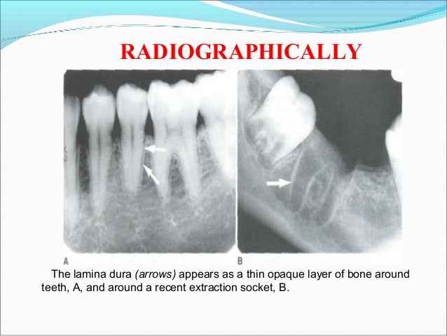 Diseases of bone and its oral aspects