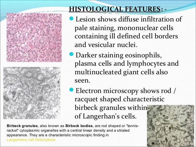 Diseases of bone and its oral aspects