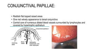 diseases-of-conjunctiva-ppt-ophthalmology-pptx