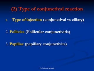 Conjunctive Injected Diseases of conjunctiva | PPT