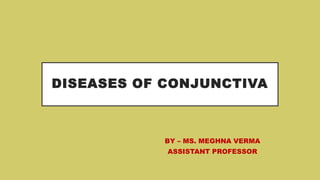 DISEASES OF CONJUNCTIVA
BY – MS. MEGHNA VERMA
ASSISTANT PROFESSOR
 