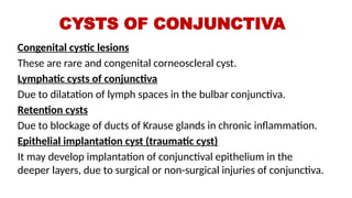DISEASES OF CONJUNCTIVA.pptx, DISEASES OF CONJUNCTIVA.pptx
