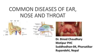 COMMON DISEASES OF EAR,
NOSE AND THROAT
Dr. Binod Chaudhary
Motipur PHC
Suddhodhan-04, Pharsatikar
Rupandehi, Nepal
 