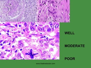 WELL MODERATE POOR www.freelivedoctor.com 