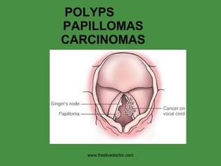 POLYPS  PAPILLOMAS CARCINOMAS www.freelivedoctor.com 