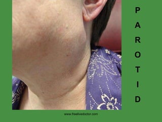 P A R O T I D www.freelivedoctor.com 