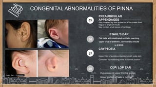 DISEASES OF EXTERNAL EAR powerpoint for Pg | PPTX
