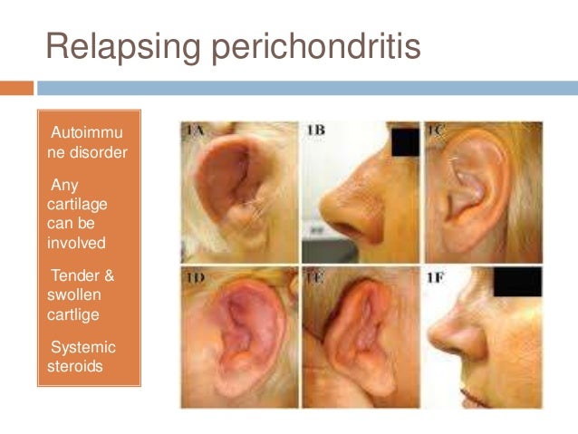 Diseases of external ear