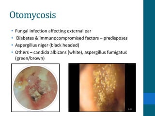Diseases of external ear | PPTX