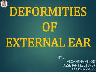 DEFORMITIES
OF
EXTERNAL EAR
BY ,
VEDANTHA VINOD
ASSISTANT LECTURER
CCON-MYSORE
 