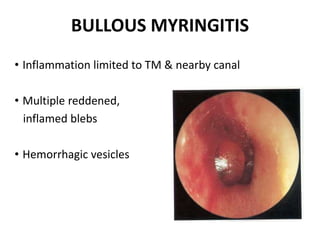 Diseases of external ear 1 | PPTX