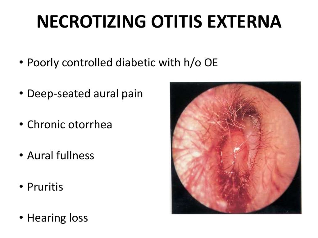 Diseases of external ear 1