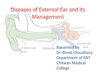 Diseases of External Ear and its
Management
Presented by
Dr. Binod Chaudhary
Department of ENT
Chitwan Medical
College
 