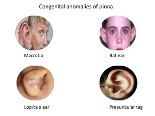 Diseases of external ear and its management | PPTX