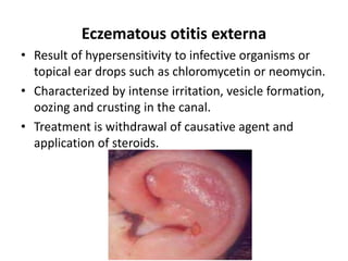 Diseases of external ear and its management | PPTX