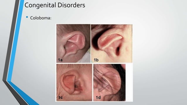 Diseases of External Ear.pptx | Ear, Nose and Throat Conditions ...