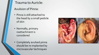 Diseases of External Ear.pptx