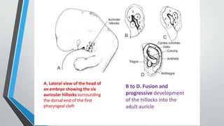 Diseases of External Ear.pptx